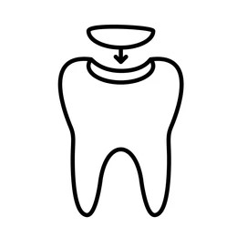 Full Mouth Rehabilitation